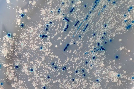 a Petri Dish with growing Virus and bacteria cells. microorganism