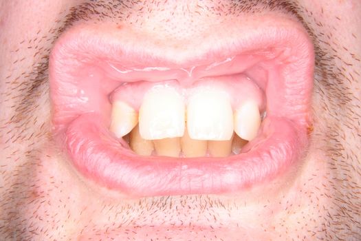 detail of the teeth of young man 