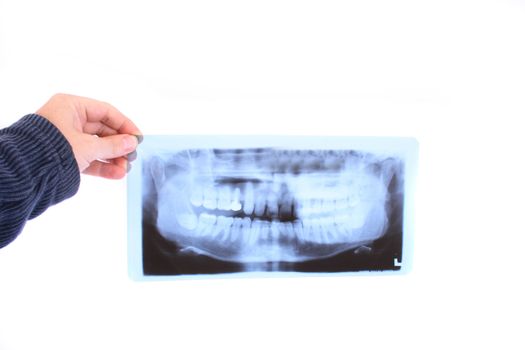 dental photo in hand on the white background