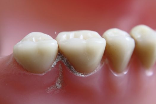 teeth problem as very nice dentist background