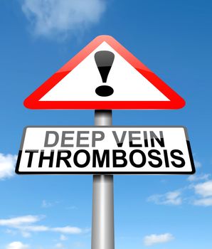 Illustration depicting a sign with a deep vein thrombosis concept.