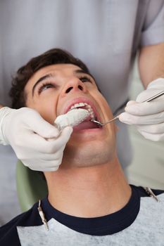 Dentist putting in molds in patients mouth