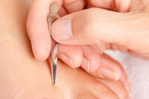 Macro detail of a heragata spear acupuncture tool being used on a foot of a young male patient