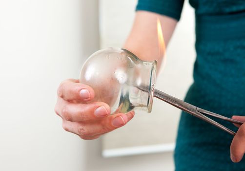 Detail of acupuncturist heating a cupping bulb with a flame
