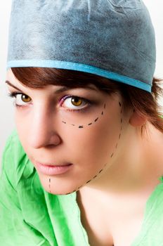 Drawn lines on a young woman face as marks for facial plastic surgery