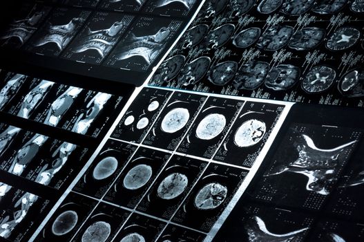 Several CT computer tomography scan images of neck and brain