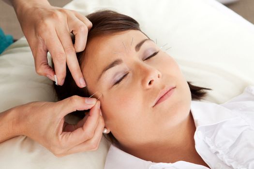 Professional acupuncturist placing a needle near the eye of a patient