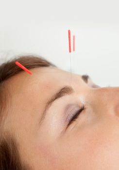 Macro detail of three needles in face of patient