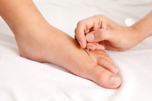 Detail of a Shonishin Acupuncture Heragata spear tool being used on the foot of a young male patient