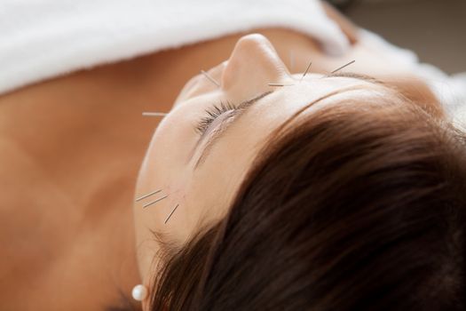 Macro detail of face of patient with facial acupuncture treatment