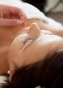 Professional acupuncture therapist placing a needle in the chin of a patient during a facial treatment