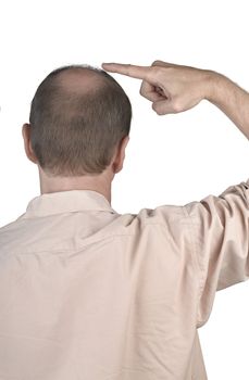 Human hair loss - adult man hand pointing his bald head