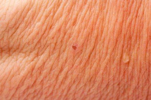 human skin as a background