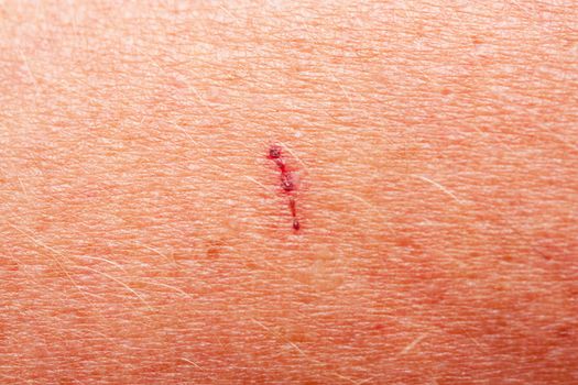 human skin as a background