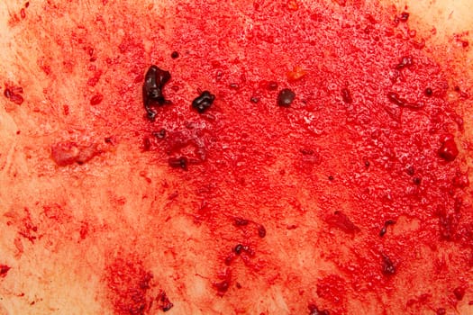 bloody background