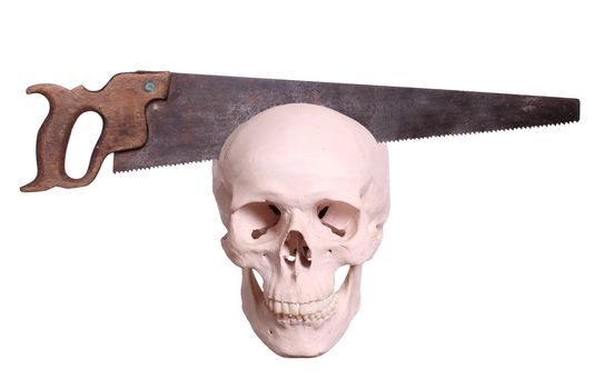 old saw cutting in skull