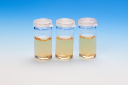 Three liquid samples in plastic vials. biological laboratory