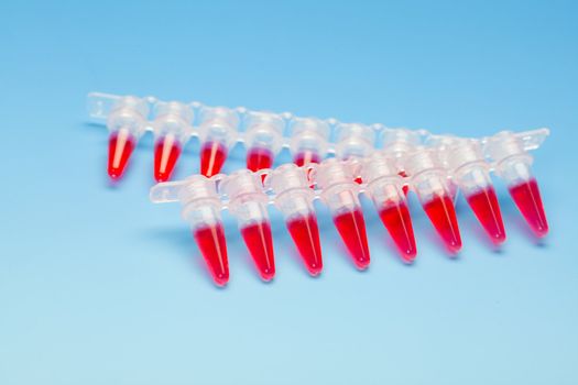 Blood screening for the AIDS virus