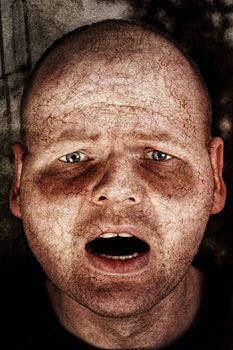 closeup portrait headshot of an diseased man