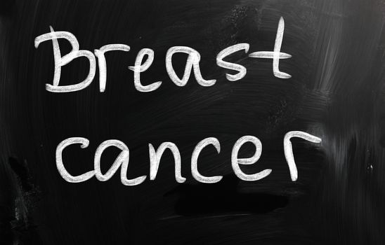 Breast cancer