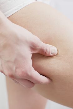 young woman holding her skin for cellulite check