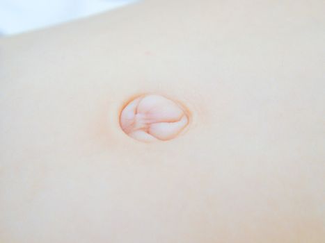 Closeup of a navel on a child