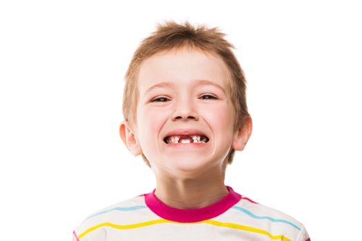 Little smiling child boy showing his first baby milk or temporary teeth fall out
