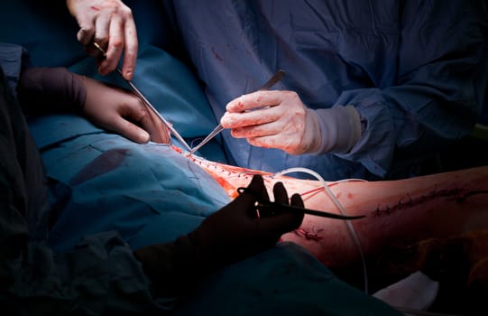 Close-up of doctors hands with gloves stitching patient's leg during operation