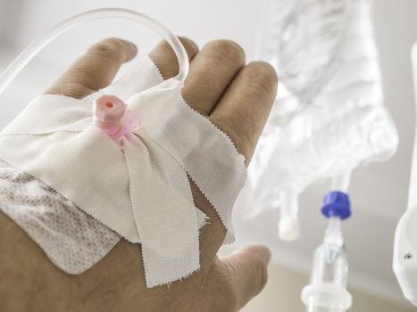 Picture of a hand with infusion bag