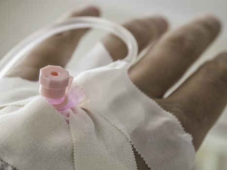 Picture of a hand with infusion needle