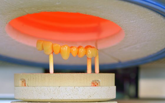 ceramic-metal compound crowns in furnace, dental technology