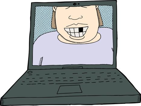 Smiling person with missing tooth on laptop screen