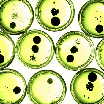 Growing Bacteria in Petri Dishes on agar gel as a part of scientific experiment. Macro shot.