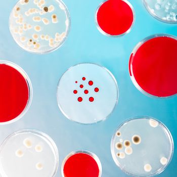 A Petri dishes on the glass table. Petri plate or cell culture dish is used by biologists to culture cells, mold, fungi, bacteria or small moss plants.