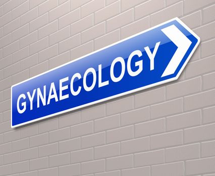 Illustration depicting a sign directing to Gynaecology.