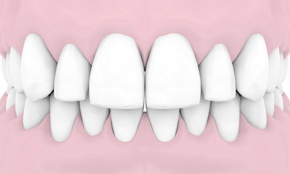 Dental implants isolated on white background