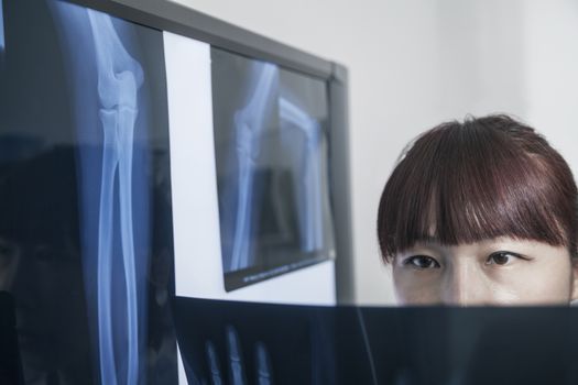 Female doctor looking at x-ray of human bones