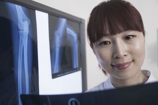 Smiling female doctor looking at x-ray of human bones