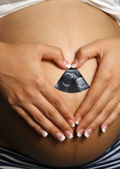 A woman who is eight months pregnant forms a heart over her belly with her hands, within which appears her ultrasound image.