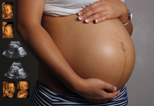 Close-up of the belly of an 8-month-pregnant woman, with 2-D and 3-D ultrasound images.