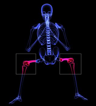 painful knee illustration made in 3d software