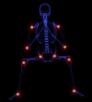 3d illustration - painful joints