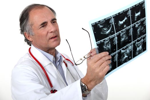 Doctor examining a scan