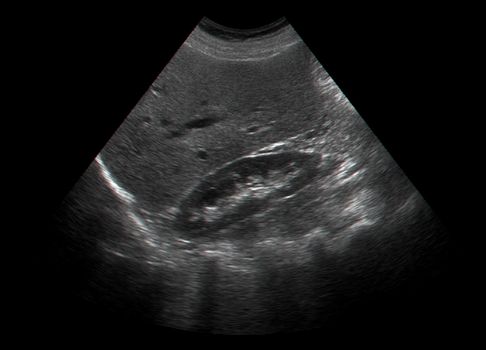 Ultrasound examination of  human internal organs