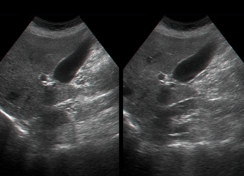 Ultrasound examination of  human internal organs