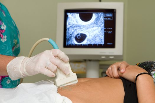 Sonographer technician holds an ultrasound transducer to diagnose the condition of a pregnant woman with a view of the woman's uterus on the computer screen.