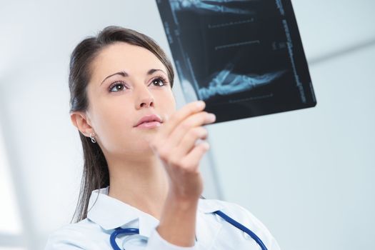 Young woman doctor looking at x-ray photo 