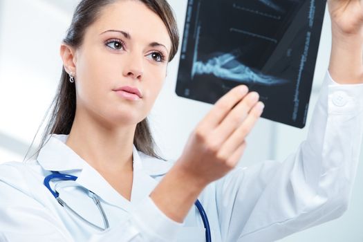 Young woman doctor looking at x-ray photo 