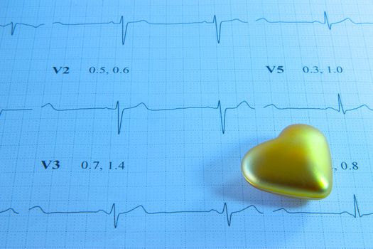 Golden heart on EKG printout