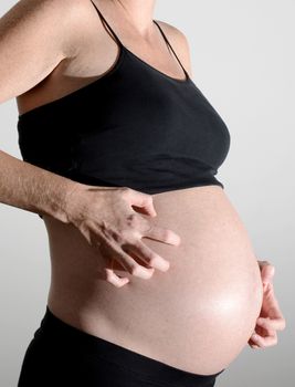 pregnant woman scratching an itching stomach